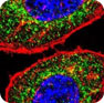 Glucocorticoid Receptor Antagoniat focused library